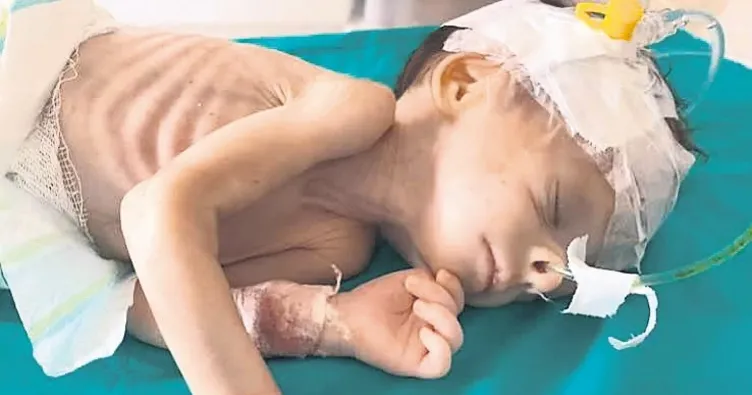 Gazze’de bebekler yaşam mücadelesi veriyor