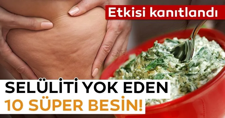 Selülit nedir? Selülit nasıl geçer?