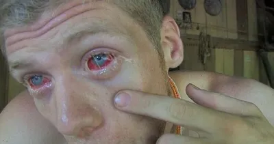 İnanılmaz olay! Koronavirüs öncesi katıldığı kabilede yarasa yedi ve...