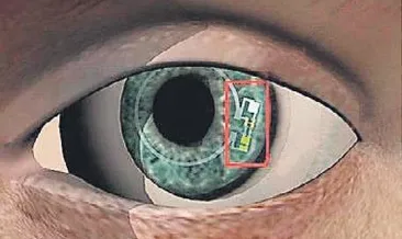 Şeker seviyesini ölçen ‘akıllı lens’