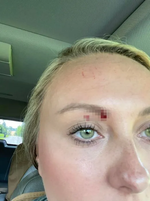 ABD’de dehşet anları: Kızının çığlıklarını duyunca dışarı fırladı! Yılanın hedefi oldu