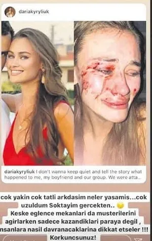 Şeyma Subaşı’nın arkadaşı Daria Kyryliuk kim tarafından darp edildi? Olayın tüm gerçekleri ortaya çıktı!