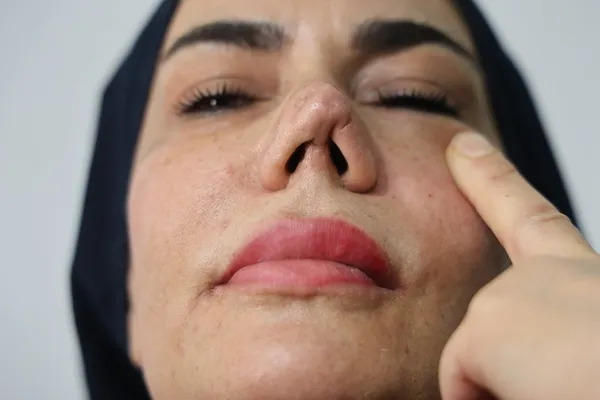bakim-merkezinde-burnu-kirilinca-hayati-kabusa-dondu-4-yilda-tam-4-kez-bicak-altina-yatti-hem-yandi-hem-yirtil-1787137436280.jpg