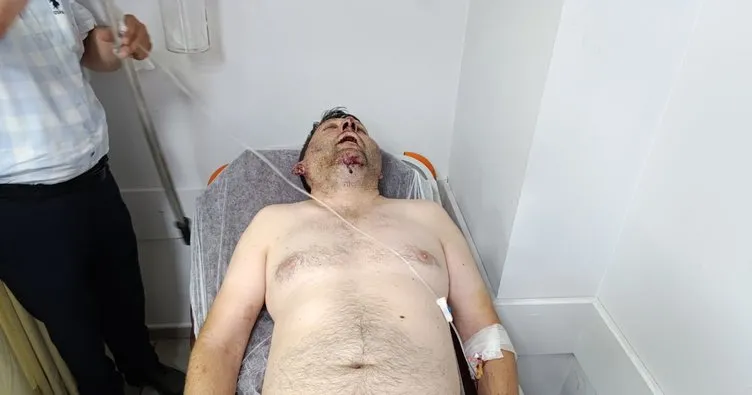 CHP’li Başkan makamında adam dövdürdü, dayaktan gözaltına alındı