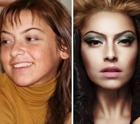 Ünlülerin estetiksiz hali