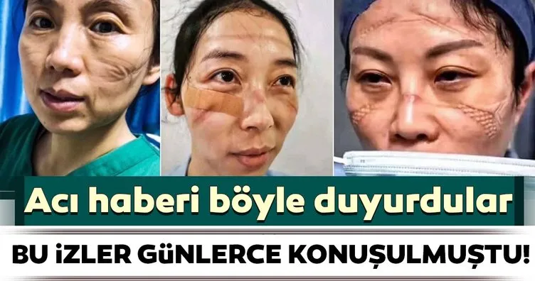 Koronavirüs ile mücadelenin izleri günlerce konuşulmuştu! Acı haberi duyurdular