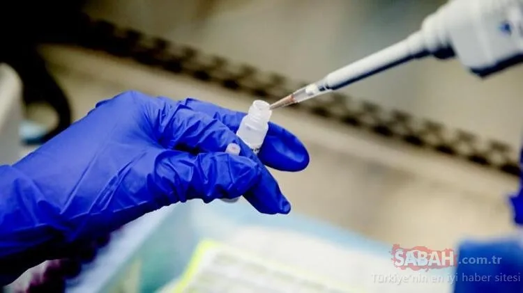 Son dakika: Corona virüs aşısı insanlar üzerinde test edilmeye başlandı!