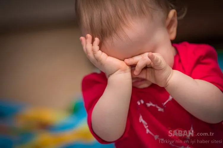 Bebeklerde göz yanmasına doğal çözümler