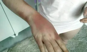‘O erkeğin fotoğrafını neden beğendin’ deyip beyzbol sopasıyla sevgilisini dövmüştü: 10 ay hapis cezası aldı #izmir ‘O erkeğin fotoğrafını neden beğendin’ deyip beyzbol sopasıyla sevgilisini dövmüştü: 10 ay hapis cezası aldı #izmir