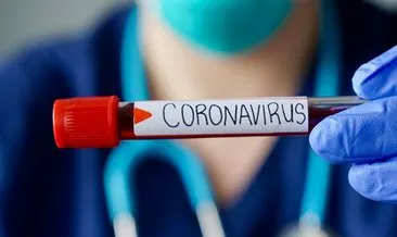 E-nabız giriş ile Covid-19 test sonucu kaç günde çıkar, sorgulama nasıl yapılır? Koronavirüs test sonucu öğrenme ekranı