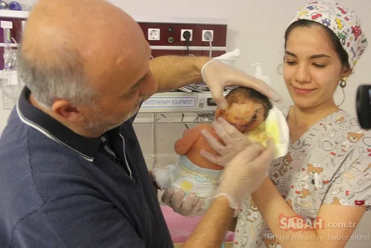 Hatay’da iki kafalı bebek dünyaya geldi Sayfa 5 Son Hatay’da iki kafalı bebek dünyaya geldi Sayfa 5 Son