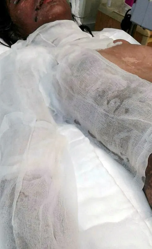 Psikiyatristin Verdigi Ilaclari Kullanan Genc Kiz Yasam Savasi Veriyor Son Dakika Haberler