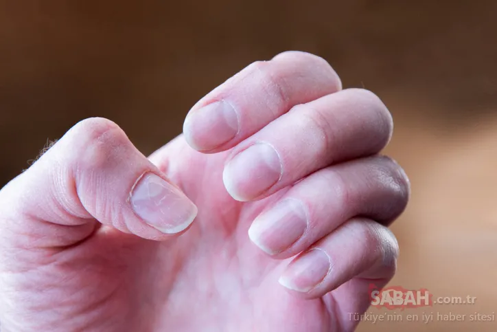 Bilim insanları açıkladı: Tırnaklardaki bu değişim kanserin gizli işaretiymiş!
