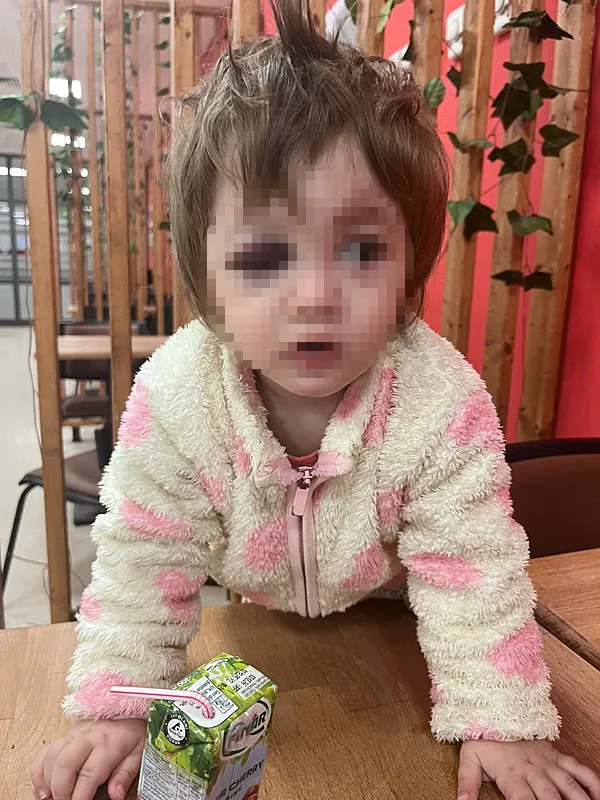 yalovadaki-14-aylik-bebegin-de-darp-edildigi-olayin-sanigi-savurdugum-cisim-cocuga-denk-geldi-1772033259127.jpg (600×800)