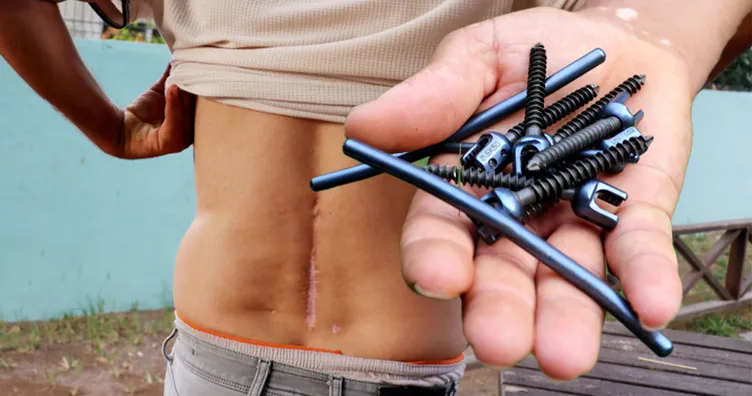 Bel ameliyatları hayatını kararttı: Sakat kalacağımı söyledi! 9 platin ve Hepatit B