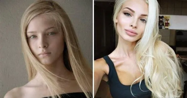 Rus kadınlarının estetikle değişimi