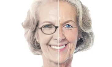 Katarakt cerrahisinde devrim