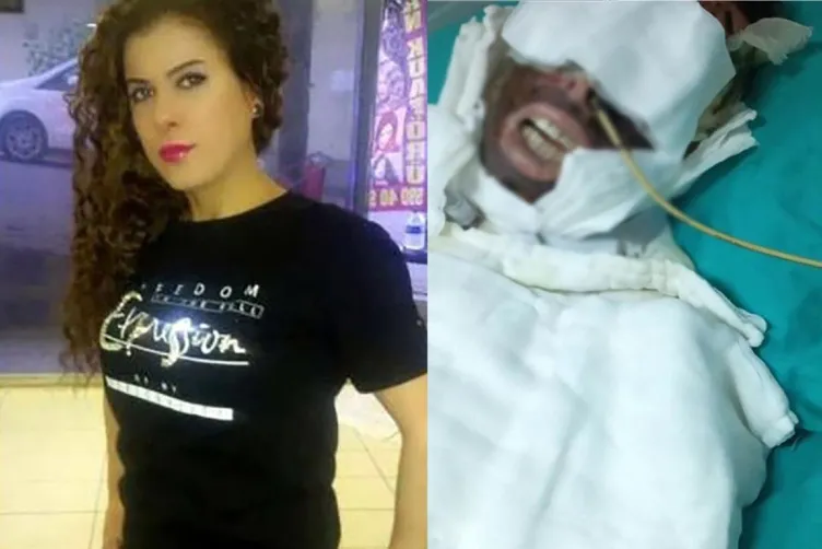 Yasemin Uzunçelebi’yi kimyasal dökerek yakmıştı! Saplantılı aşığa koğuş dayağı: Kemiklerini kırdılar!