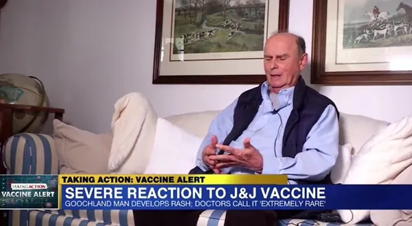 ABD’de koronavirüse karşı yapılan Johnson and Johnson aşısı bu hale getirdi