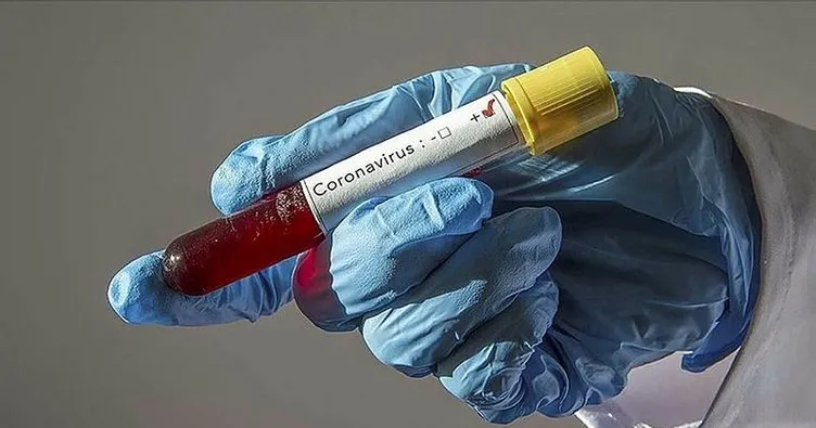 YTÜ, Kovid-19’a karşı aşı geliştirme çalışmalarına başladı