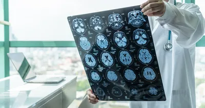 Yapılan bu hata beyni 20 yıl birden yaşlandırıyor! Alzheimer ilk sinyallerini 30’lu yaşlarda veriyor...