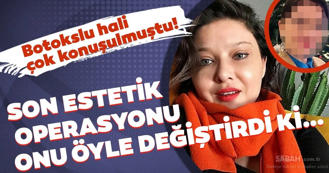 Nurgül Yeşilçay’ın botokslu hali çok konuşulmuştu! Son estetik