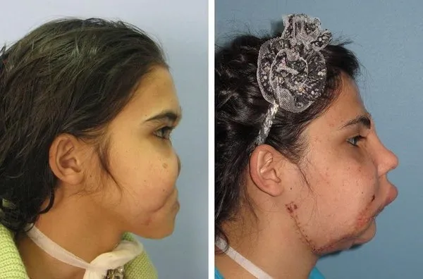 Hatice Nergis yeni yüzünü ilk kez gördü