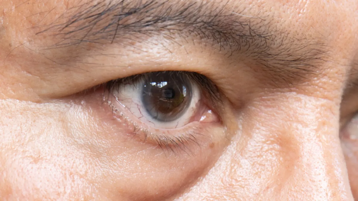 Türkiye’de 2 milyon kişi bu tehlikeyle yaşıyor! Sinsi sinsi ilerliyor, fark edildiğinde çok geç olabilir… Türkiye’de 2 milyon kişi bu tehlikeyle yaşıyor! Sinsi sinsi ilerliyor, fark edildiğinde çok geç olabilir…