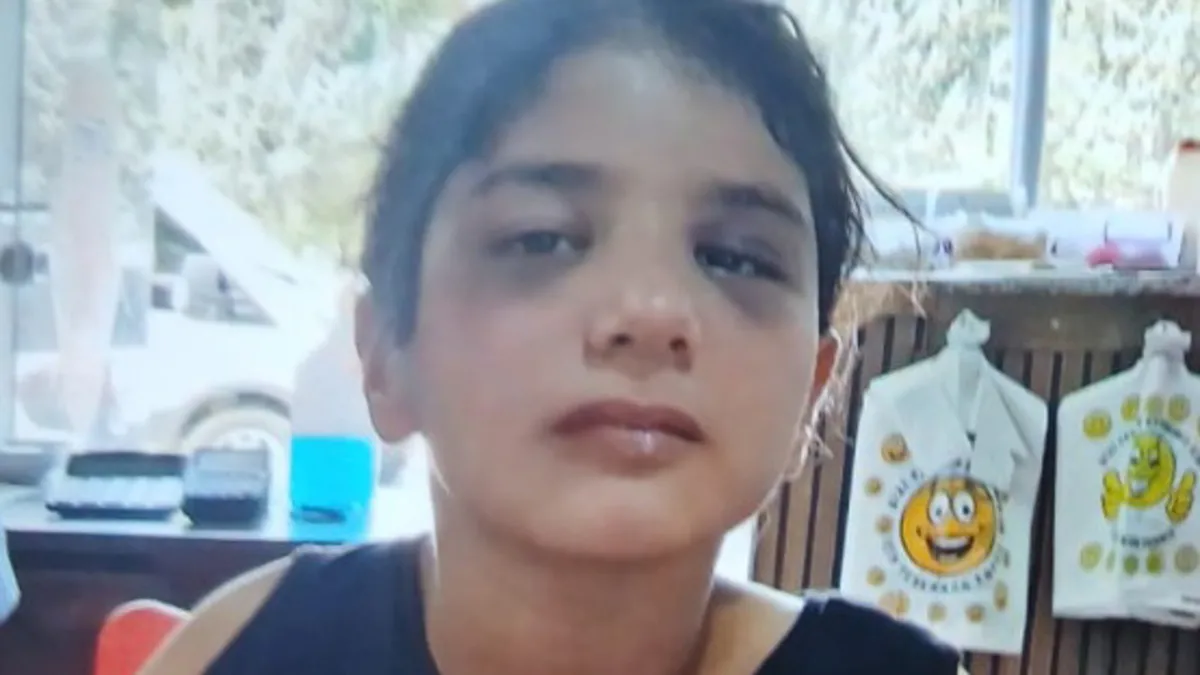 Aksaray'da 10 yaşındaki otizmli çocuğa komşu şiddeti iddiası