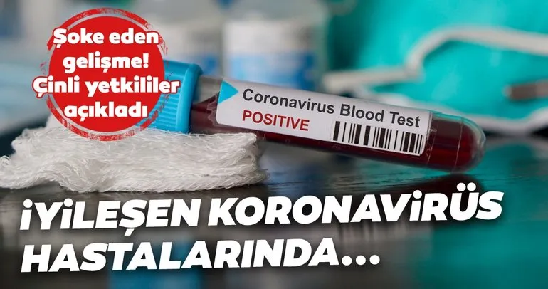 Son dakika haberi: Koronavirüsü Kovid-19 hakkında flaş gelişme! İyileşen hastalarda yeniden koronavirüsüne rastlandı