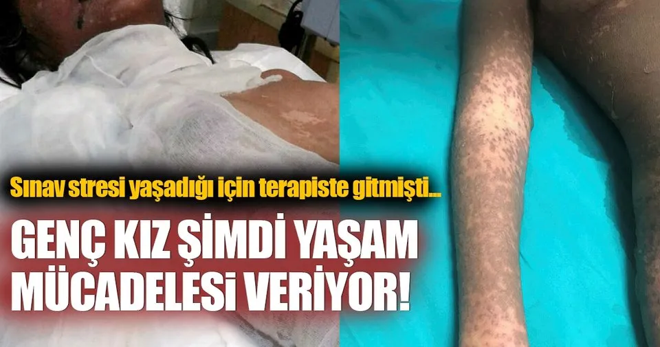 Psikiyatristin Verdigi Ilaclari Kullanan Genc Kiz Yasam Savasi Veriyor Son Dakika Haberler