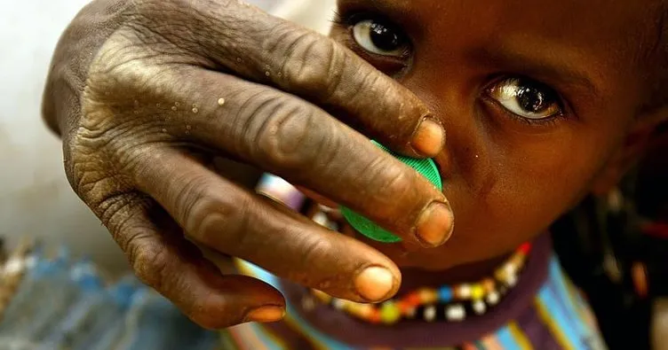 ’Güney Sudan’da 20 bin çocuk açlıktan ölebilir’