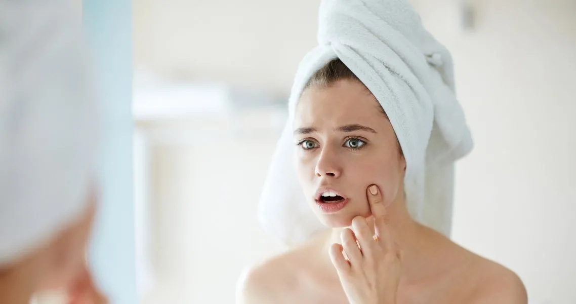 yuzde cikan kucuk beyaz noktalar nasil