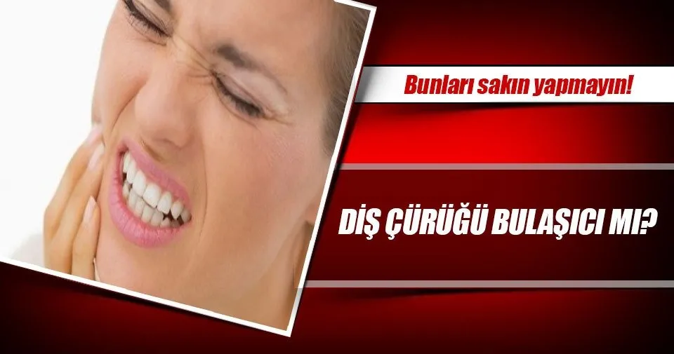 Dis Curugu Bulasici Mi Son Dakika Haberler