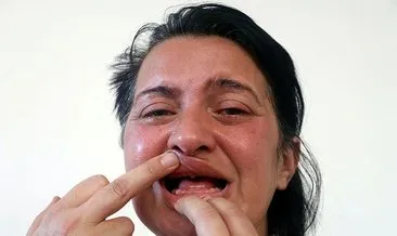 ’Bembeyaz dişlerim olsun’ dedikten sonra 32 dişinden olan o kadına müjdeli haber