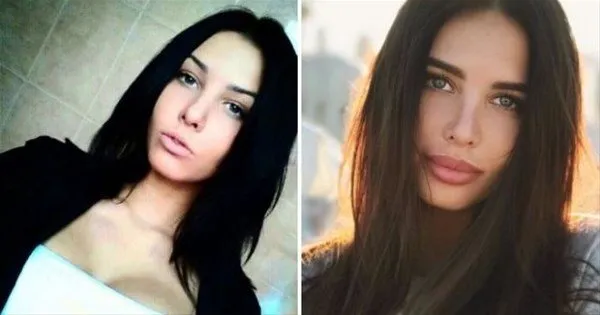 Rus kadınlarının estetikle değişimi