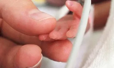 Yeni Dogan Bebeklerde Gorulen Sorunlar Ve Cozum Onerileri Bebek Haberleri