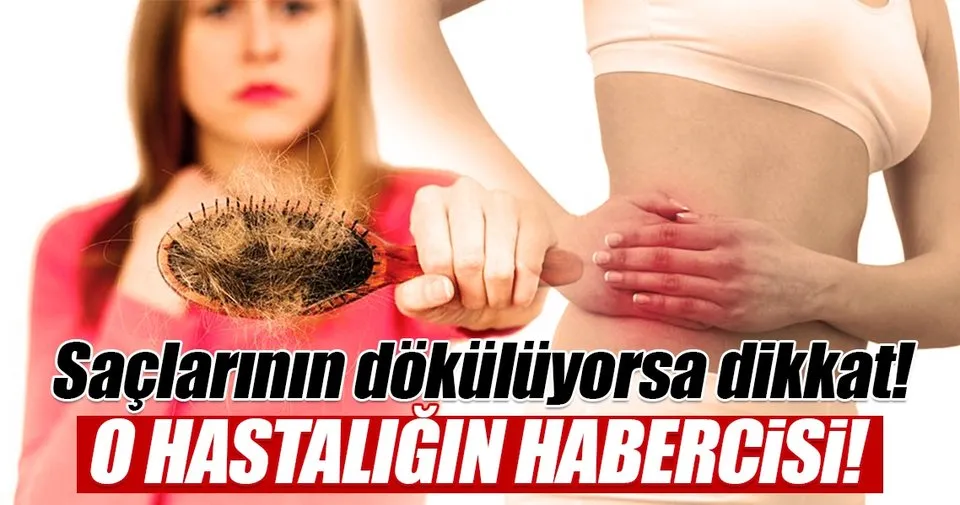 Sac Dokulmesi Bu Hastaliklarin Habercisi Olabilir Saglik Haberleri