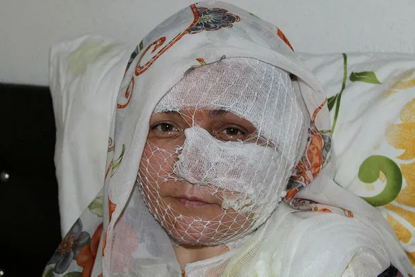 Diyarbakır’da eşinin kızgın yağla yaktığı Meral Müjdeci: Cezaevinden çıkarsa bu kez öldürür beni - 1