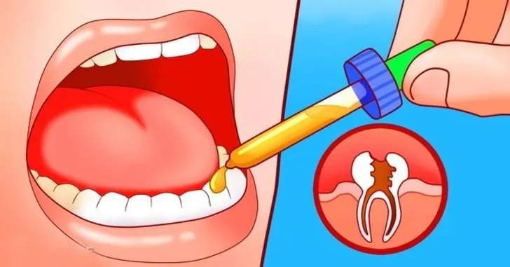 Bu yöntem diş ağrısını anında yok ediyor!