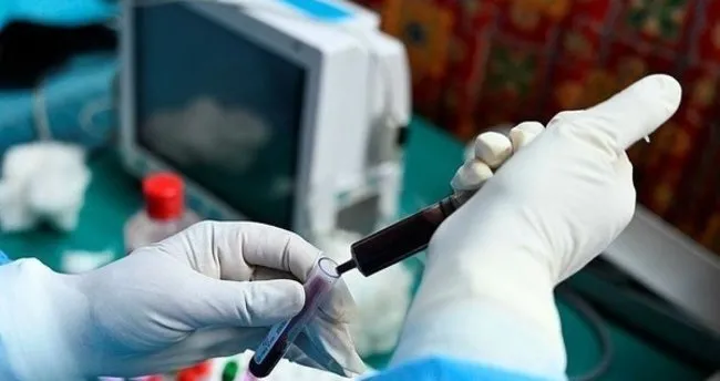 https www sabah com tr saglik 2020 12 03 koronavirus test sonucu sorgulama ekrani e nabiz ile covid 19 test sonucu kac gunde cikar nasil ogrenilir