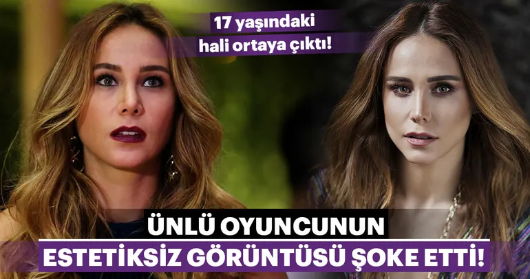 Ünlü isimlerin estetikle müthiş değişimleri