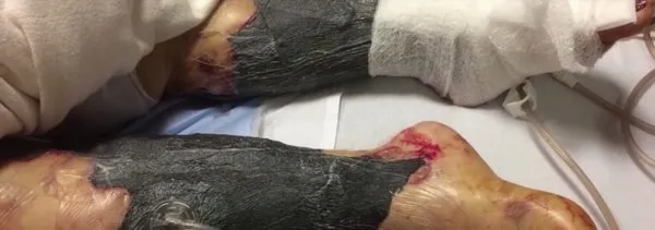 Yemeğini yedi sonra hayatını kaybetti