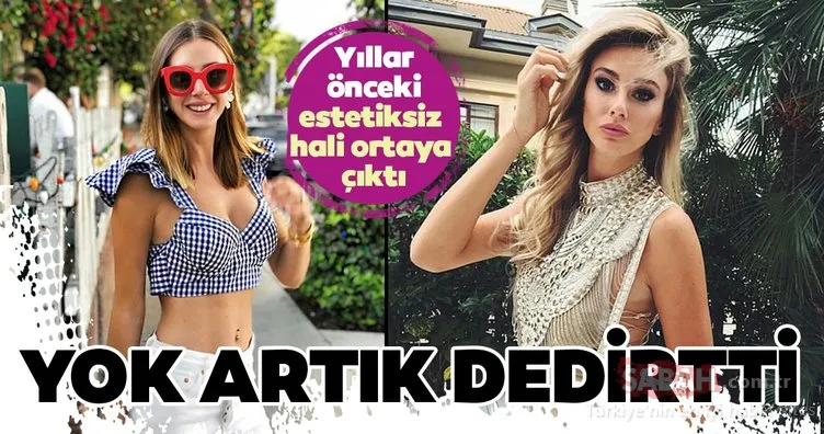 Şeyma Subaşı yıllar önceki haliyle yok artık dedirtti! İşte Şeyma Subaşı ve diğer ünlülerin estetiksiz halleri...