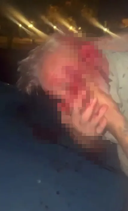 Patron adam tutup çalışanına kabusu yaşattı! Korkunç görüntüyü ’Dana kesmedik’ diye paylaştılar!