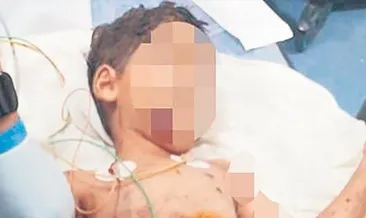 Sokak köpekleri bu hale getirdi