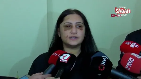 Samsun'da İbrahim Zarap'ın öldüresiye dövdüğü eski eşi Emriye Metoğlu'ndan açıklama | Video