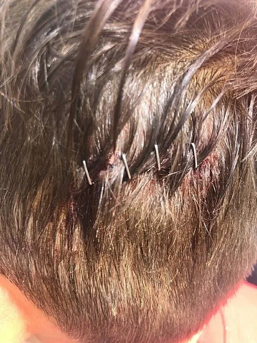 İzmir’de başıboş köpek dehşeti: 6 yaşındaki Baran ölümden döndü!