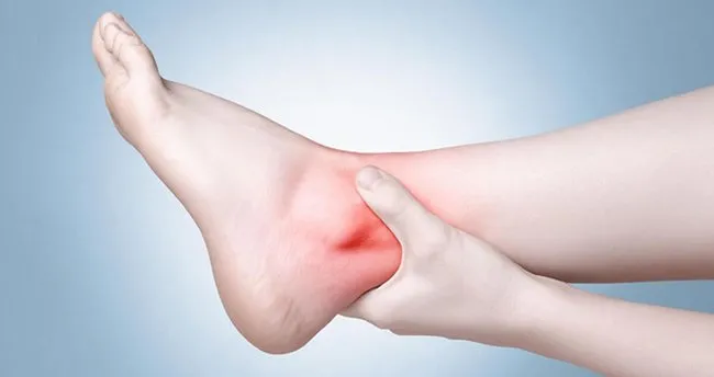 ayak burkulmasina ne iyi gelir