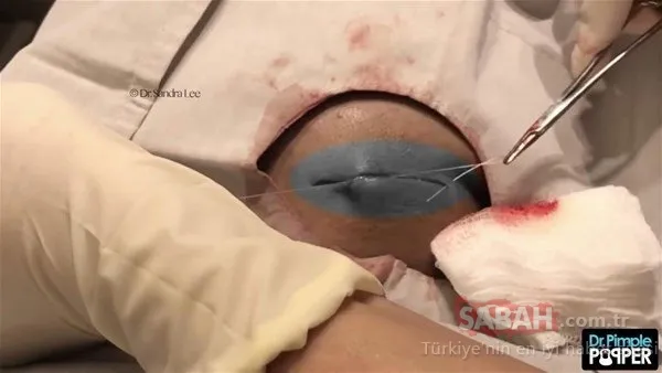 Doktora bu halde geldi! Sonrasındaysa...